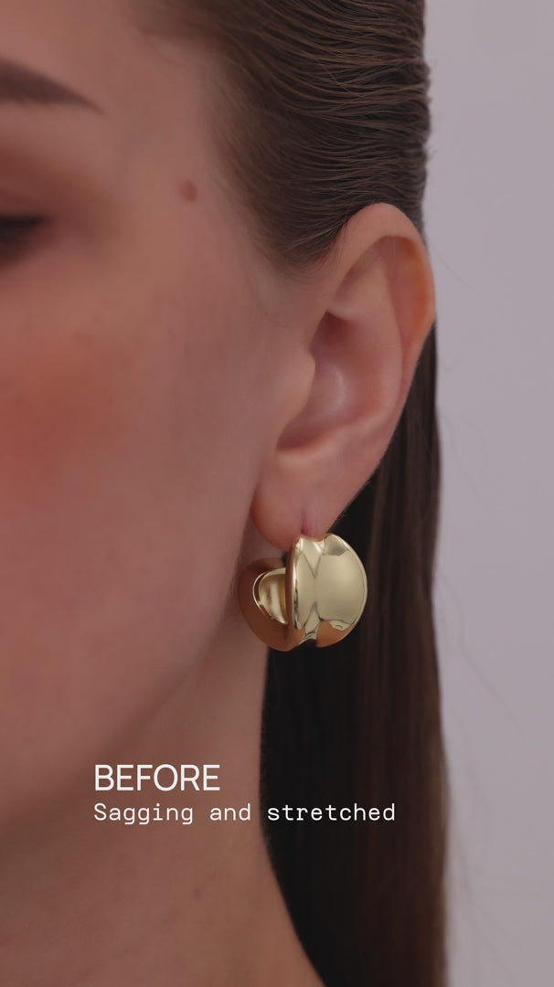 Solleva Lobe Lifters